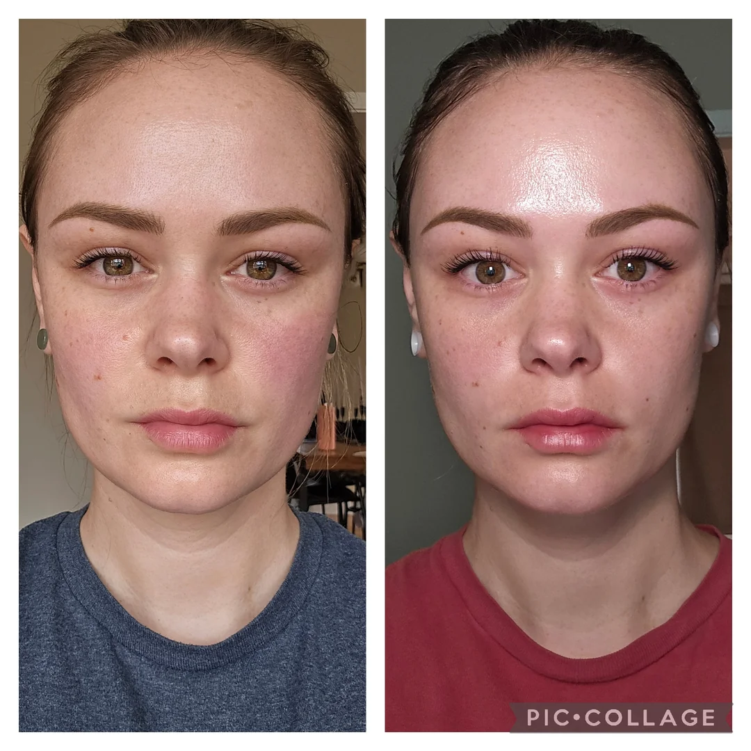 2 month red light therapy progression